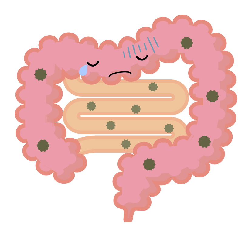 不健康な大腸のイラスト