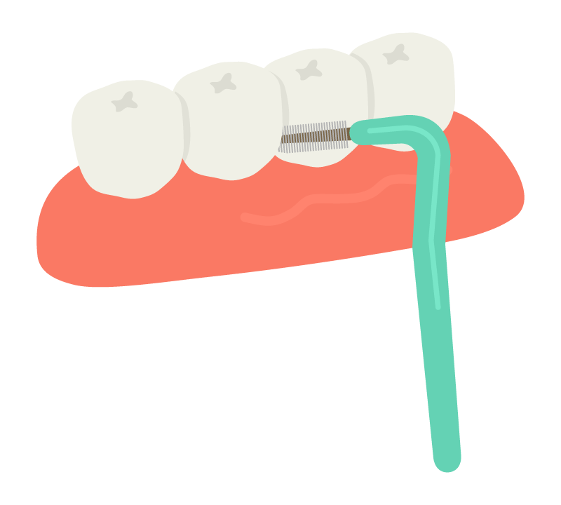 歯間ブラシのイラスト02