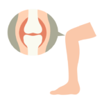 膝関節のイラスト