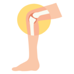 膝関節のイメージイラスト