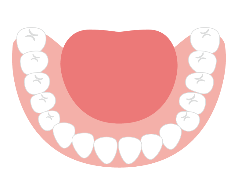 歯並びのイラスト