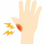 手や指の怪我のイラスト