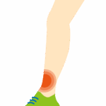 陸上選手の足の捻挫や怪我のイラスト